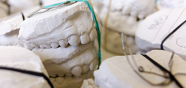 stałe protezy zębowe